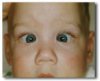 Cross eyed.jpg