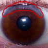 eye.png